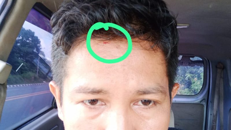 Korban Penganiayaan Yang Terjadi Di SPBU 24-375-82 Desak Polres Tebo Segera Tangkap Pelakunya